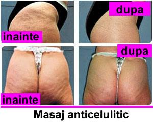 Masaj de relaxare si anticelulitic la domiciliul clientei! - Pret | Preturi Masaj de relaxare si anticelulitic la domiciliul clientei!