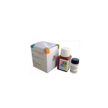 Proteine specifice CRP Biolabo - Pret | Preturi Proteine specifice CRP Biolabo