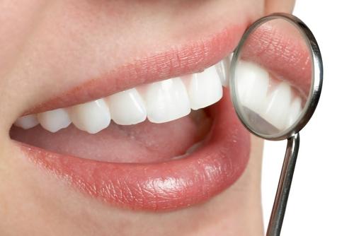 Super oferta, Igienizare dentara, Timisoara, 40 Lei - Pret | Preturi Super oferta, Igienizare dentara, Timisoara, 40 Lei